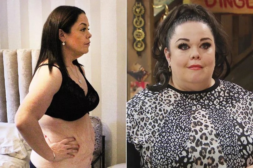 Emmerdale’s Lisa Riley’s life-changing 18-month weight loss journey that left her in ‘constant pain’